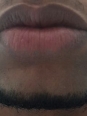 Photo #1