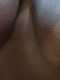Photo #1